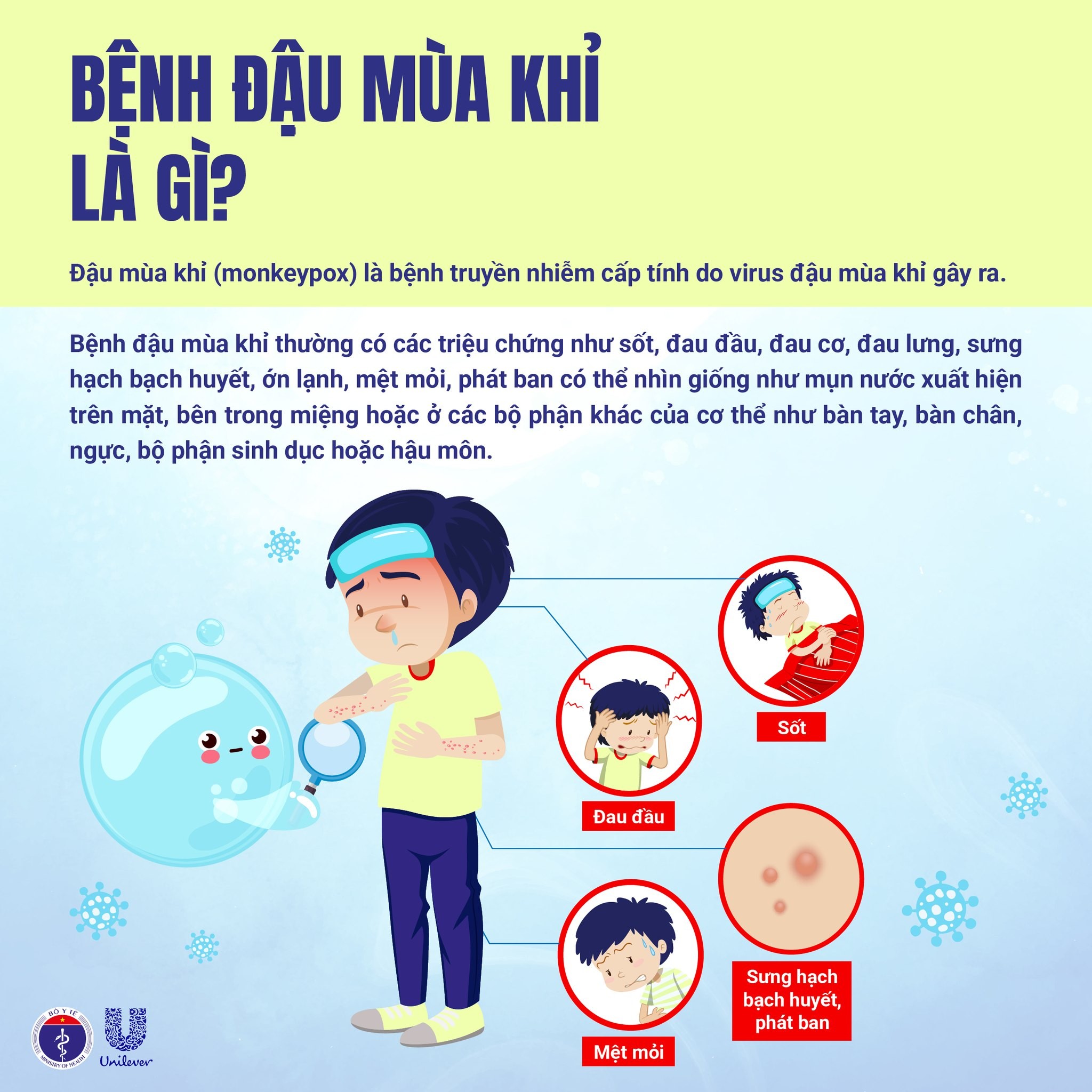 CHỦ ĐỘNG PHÒNG CHỐNG BỆNH ĐẬU MÙA KHỈ (MPOX)